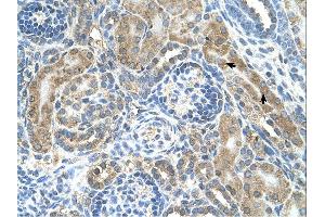 Immunohistochemistry (IHC) image for anti-Cysteine-Rich with EGF-Like Domains 1 (CRELD1) (C-Term) antibody (ABIN2782094) (CRELD1 anticorps  (C-Term))