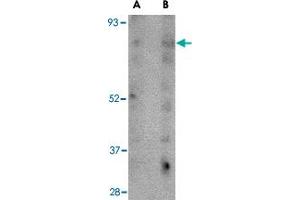 Western blot analysis of SCARB2 in human skeletal muscle tissue lysate with SCARB2 polyclonal antibody  at (A) 1 and (B) 2 ug/mL . (SCARB2 anticorps  (C-Term))