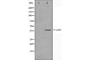 Western blot analysis on HeLa cell lysate using CDK7 Antibody,The lane on the left is treated with the antigen-specific peptide.