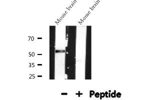 Western blot analysis of MeCP2 expression in Mouse brain lysate