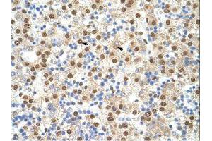 Image no. 3 for anti-Interleukin enhancer-binding factor 3 (ILF3) (AA 41-90) antibody (ABIN6736203) (Interleukin enhancer-binding factor 3 (ILF3) (AA 41-90) anticorps)