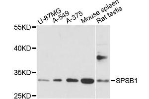 Western blot analysis of extracts of various cell lines, using SPSB1 antibody. (SPSB1 anticorps)