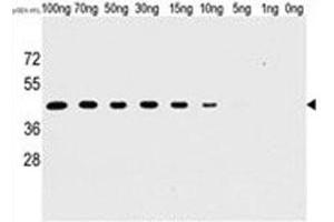 Western blot analysis of H1L antibody and recombinant H1L protein. (Tyr/ser Protein Phosphatase anticorps)
