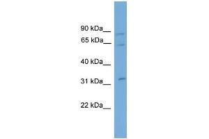 WB Suggested Anti-CAPN11 Antibody Titration: 0. (CAPN11 anticorps  (N-Term))