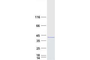 Validation with Western Blot