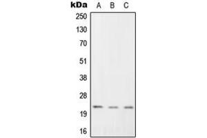 Western blot analysis of RGS1 expression in K562 (A), Raw264. (RGS1 anticorps  (Center))