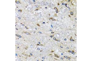 Immunohistochemistry of paraffin-embedded mouse spinal cord using BLZF1 antibody (ABIN5973830) at dilution of 1/100 (40x lens). (BLZF1 anticorps)