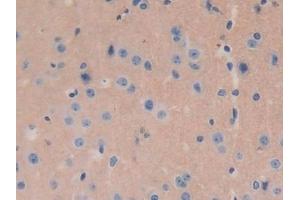 Detection of GNg8 in Mouse Brain Tissue using Polyclonal Antibody to G Protein Gamma 8 (GNg8)