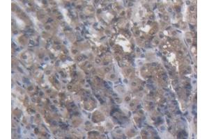 Detection of KTN1 in Rat Stomach Tissue using Polyclonal Antibody to Kinectin 1 (KTN1) (KTN1 anticorps  (AA 1162-1325))