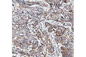 IHC analysis of MUT using anti-MUT antibody (ABIN4886676). (MUT anticorps  (N-Term))