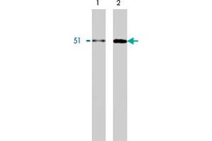 Western blot using HNRNPK monoclonal antibody, clone F45 P9 C7  on Calu-6 (1) and HT-29 (2) cell lysates. (HNRNPK anticorps  (C-Term))