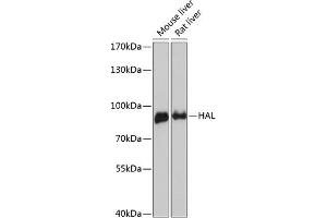 Western blot analysis of extracts of various cell lines, using HAL antibody (ABIN6130467, ABIN6141593, ABIN6141594 and ABIN6216851) at 1:3000 dilution. (HAL anticorps  (AA 1-200))
