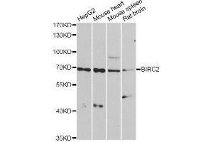Western blot analysis of extracts of various cell lines, using BIRC2 antibody.