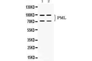 Western blot analysis of PML Protein expression in SW620 whole cell lysates ( Lane 1) and U2OS whole cell lysates ( Lane 2). (PML anticorps  (N-Term))