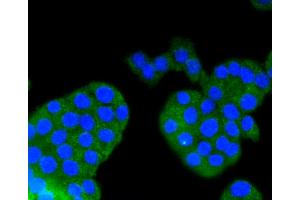 Immunofluorescence analysis of PC-12 cells using ARRB1 antibody (ABIN4903044). (beta Arrestin 1 anticorps)