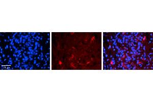Rabbit Anti-FBXO9 Antibody     Formalin Fixed Paraffin Embedded Tissue: Human Pineal Tissue  Observed Staining: Cytoplasmic in cell bodies and processes of pinealocytes  Primary Antibody Concentration: 1:100  Other Working Concentrations: 1/600  Secondary Antibody: Donkey anti-Rabbit-Cy3  Secondary Antibody Concentration: 1:200  Magnification: 20X  Exposure Time: 0.