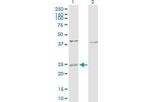 Western Blot analysis of ARL4D expression in transfected 293T cell line by ARL4D MaxPab polyclonal antibody. (ARL4D anticorps  (AA 1-201))