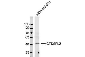 MDA-MB-231 lysates probed with CTDSPL2 Polyclonal Antibody, Unconjugated  at 1:300 dilution and 4˚C overnight incubation.