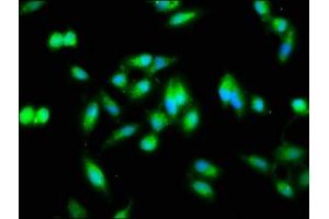 Immunofluorescence staining of Hela cells with ABIN7161777 at 1:133, counter-stained with DAPI. (NFKB2 anticorps  (AA 263-439))