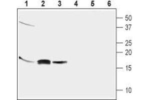 Western blot analysis of mouse brain (lanes 1 and 4), rat brain (lanes 2 and 5) and human neuroblastoma (SH-SY5Y) cell line (lanes 3 and 6) lysates:1-3. (GABA(A) Receptor-Associated Protein (GABARAP) Peptide)