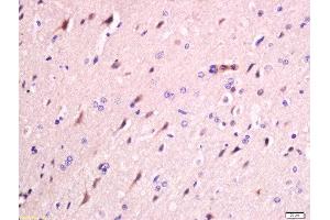 Formalin-fixed and paraffin embedded rat brain labeled with Anti-FAM134B Polyclonal Antibody, Unconjugated  at 1:200 followed by conjugation to the secondary antibody and DAB staining (FAM134B anticorps  (AA 210-310))