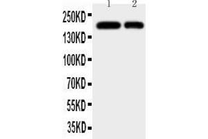 Anti-CD11b antibody, All Western blottingAll lanes: Anti-ITGAM at 0. (CD11b anticorps  (N-Term))