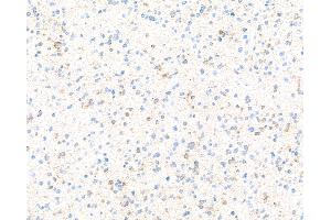Immunohistochemistry (IHC) image for anti-Doublecortin (DCX) (AA 200-250) antibody (ABIN7453969)