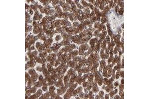 Immunohistochemical staining of human liver with CNIH polyclonal antibody  shows strong cytoplasmic positivity in hepatocytes at 1:50-1:200 dilution. (CNIH anticorps)