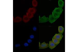 ABIN6257916 and ABIN6274881 staining Hela cells(30 min of UV treatment) by IF/ICC.