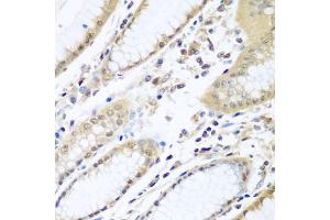 Immunohistochemistry of paraffin-embedded human stomach using WDR48 antibody (ABIN5974731) at dilution of 1/100 (40x lens). (WDR48 anticorps)