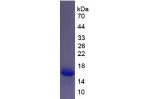 SDS-PAGE of Protein Standard from the Kit  (Highly purified E. (S100A6 Kit ELISA)
