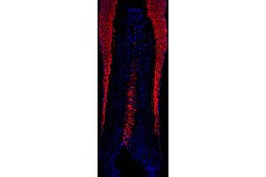 human scalp hair (courtesy of L.