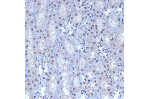 Immunohistochemistry of paraffin-embedded mouse kidney using A Rabbit mAb (ABIN7265387) at dilution of 1:100 (40x lens). (BAF53A anticorps)