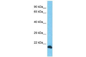 Host: Rabbit Target Name: INO80C Sample Type: PANC1 Whole cell lysates Antibody Dilution: 1. (INO80C anticorps  (N-Term))
