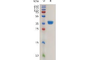 Human MC Protein, hFc Tag on SDS-PAGE under reducing condition.
