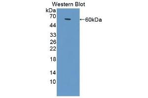 Detection of Recombinant ALCAM, Bovine using Polyclonal Antibody to Activated Leukocyte Cell Adhesion Molecule (ALCAM) (CD166 anticorps  (AA 28-527))