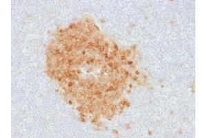 Formalin-fixed, paraffin-embedded human Tonsil stained with CD10 Mouse Monoclonal Antibody (MME/1893).