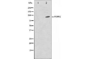Western blot analysis on A549 cell lysate using FGFR2 Antibody,The lane on the left is treated with the antigen-specific peptide. (FGFR2 anticorps  (C-Term))