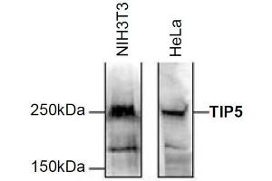 Western Blot of anti-TIP5 antibody Western Blot results of Rabbit anti-TIP5 antibody.