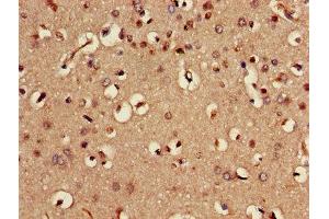 Immunohistochemistry of paraffin-embedded human brain tissue using ABIN7168982 at dilution of 1:100 (STK24 anticorps  (AA 1-431))