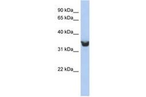 Image no. 1 for anti-delta-Like 1 Homolog (Drosophila) (DLK1) (AA 251-300) antibody (ABIN6743247) (DLK1 anticorps  (AA 251-300))