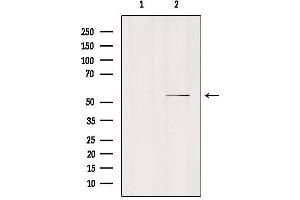 Western blot analysis of extracts from mouse brain, using MOT6 Antibody. (SLC16A5 anticorps  (Internal Region))
