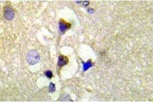 Immunohistochemistry (IHC) analyzes of p-PKD1/PKC-mu antibody in paraffin-embedded human brain tissue. (PKC mu anticorps  (pSer910))