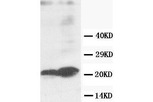 Anti-GST3/GST pi antibody, Western blotting Lane 1: MCF-7 Cell Lysate Lane 2: COLO320 Cell Lysate (GSTP1 anticorps  (C-Term))