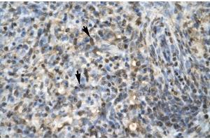 Rabbit Anti-EGR1 Antibody Catalog Number: ARP32241 Paraffin Embedded Tissue: Human Spleen Cellular Data: Spleen cells Antibody Concentration: 4.