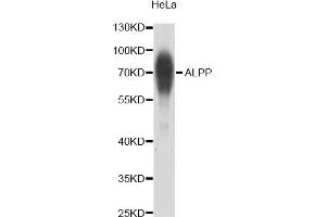 Western blot analysis of extracts of HeLa cells, using ALPP antibody (ABIN2561070) at 1:1000 dilution. (PLAP anticorps)