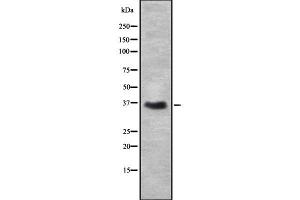 Western blot analysis of DAZL using Jurkat whole cell lysates