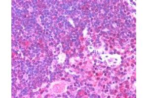 ABIN185677 (2. (UNC13D anticorps  (Internal Region))