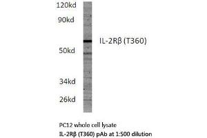 Western blot (WB) analysis of IL-2Rβ antibody in extracts from PC12 cells. (IL2 Receptor beta anticorps)