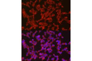 Immunofluorescence analysis of SH-SY5Y cells using Ret Rabbit pAb (ABIN6130657, ABIN6146873, ABIN6146874 and ABIN6213585) at dilution of 1:50 (40x lens).